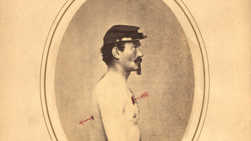 Injured American Civil War Soldier