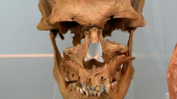 Skull of Heny