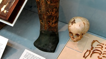 Cartonnage Mummy Case & Skeleton of a Child with a Rare Bone Disease