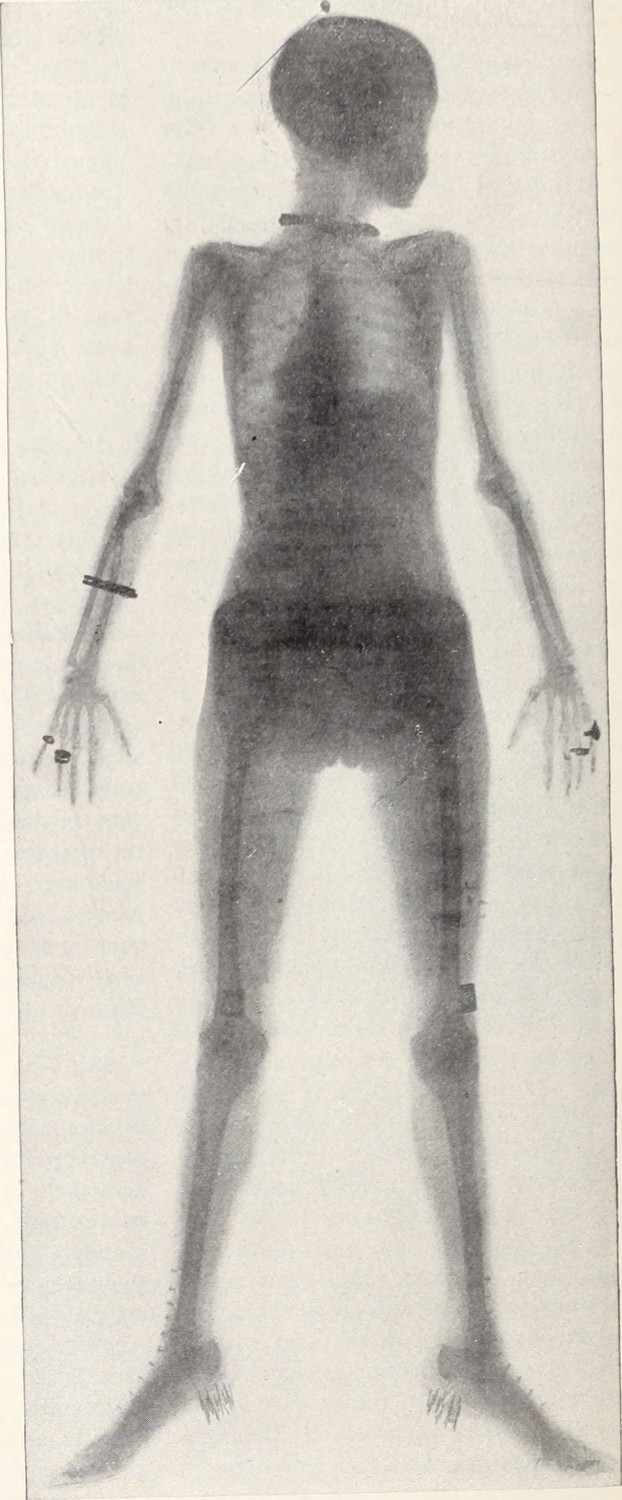 19245.jpg