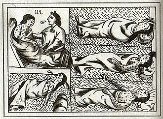 Aztec victims of smallpox