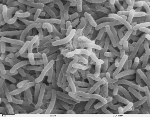 Cholera Bacterium (by Ronald Taylor, Tom Kirn, Louisa Howard, Public Domain)