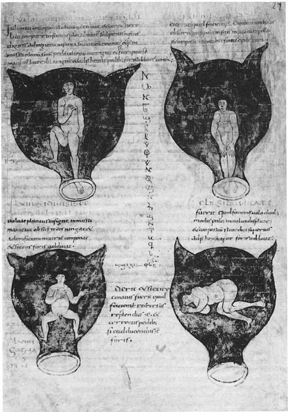 Positions of the Embryo in the Uterus in Soranus of Ephesus' Gynaecology