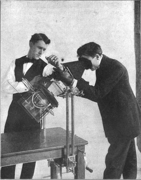 First Radiographers Hand El descubrimiento de los rayos X - Enciclopedia de la Historia del Mundo