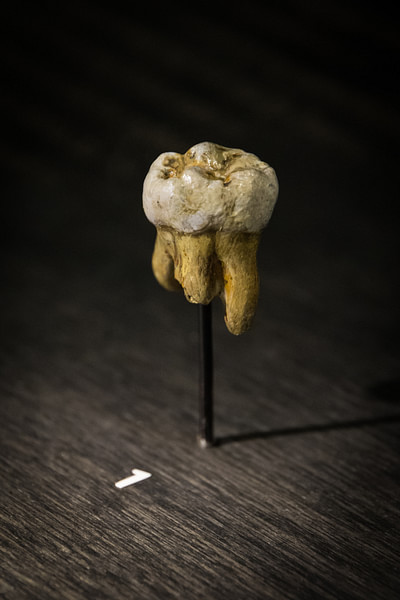 Denisovan Molar (by Thilo Parg, CC BY-SA)