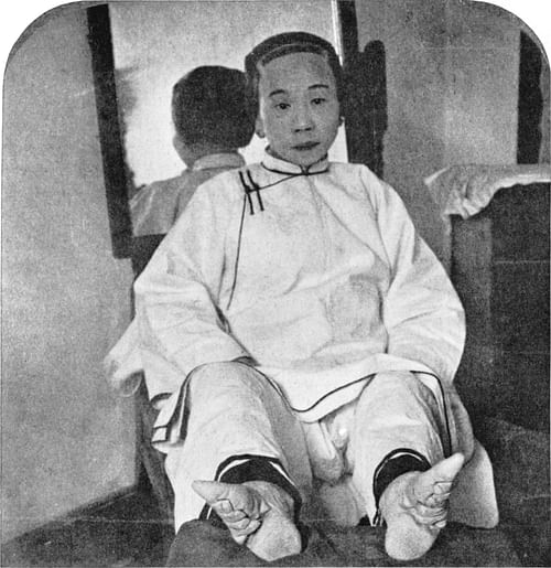 Woman with Bound Feet