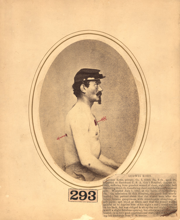 Injured American Civil War Soldier