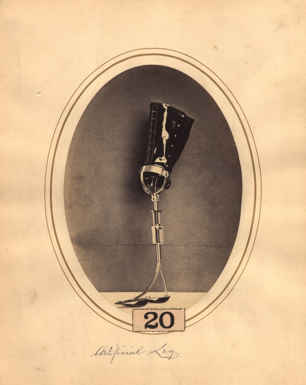 American Civil War Leg Prosthesis