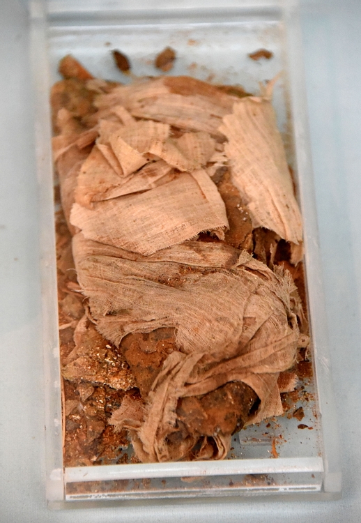 Mummified Lung of the Scribe Sutimose