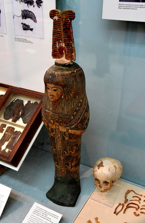 Cartonnage Mummy Case & Skeleton of a Child with a Rare Bone Disease